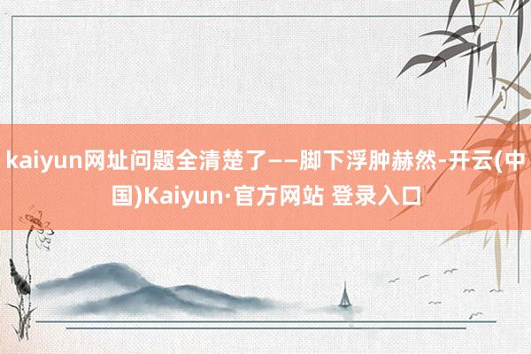 kaiyun网址问题全清楚了——脚下浮肿赫然-开云(中国)Kaiyun·官方网站 登录入口